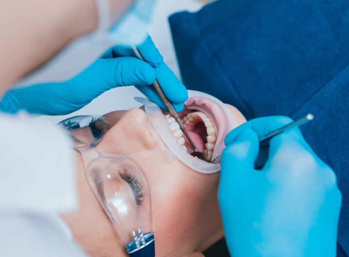 ¿Dónde realizarse un diseño de sonrisa en Tenerife?
